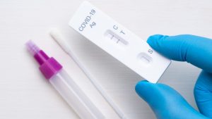 Test antigenico per il Covid positivo (Immagine di repertorio)