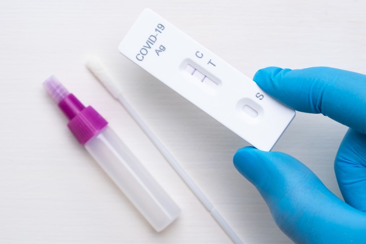 Test antigenico per il Covid positivo (Immagine di repertorio)